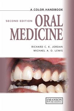 Oral Medicine (eBook, ePUB) - Lewis, Michael; Jordan, Richard