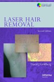 Laser Hair Removal (eBook, ePUB)
