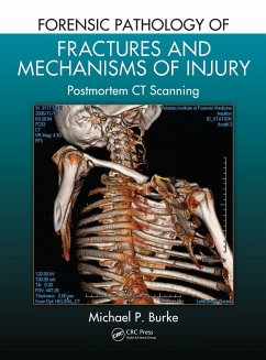 Cover Forensic Pathology of Fractures and Mechanisms of Injury (eBook, ePUB)