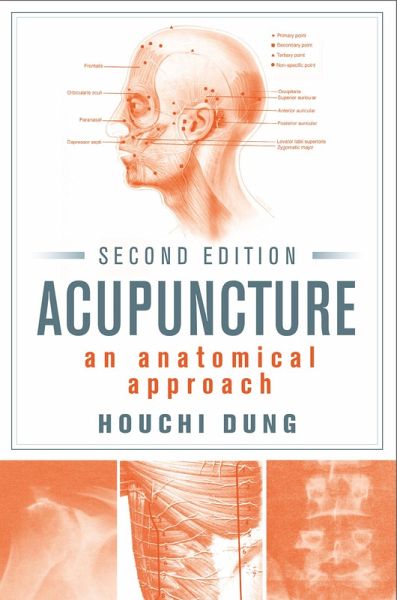 Acupuncture (eBook, ePUB)