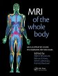 MRI of the Whole Body (eBook, ePUB) - Bild 1