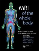 MRI of the Whole Body (eBook, ePUB)