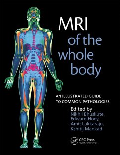 MRI of the Whole Body (eBook, ePUB) - Bhuskute, Nikhil; Hoey, Edward; Lakkaraju, Amit; Mankad, Kshitij