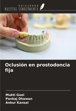 Cover Oclusión en prostodoncia fija