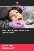 Restaurações Estéticas Anteriores