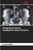 Imaging primary malignant bone tumors