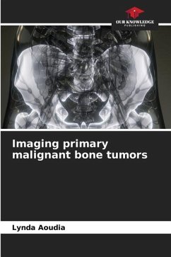 Imaging primary malignant bone tumors - Aoudia, Lynda