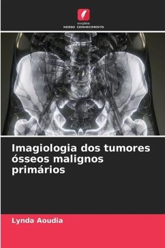 Imagiologia dos tumores ósseos malignos primários - Aoudia, Lynda