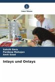 Inlays und Onlays