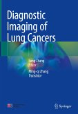 Diagnostic Imaging of Lung Cancers (eBook, PDF)