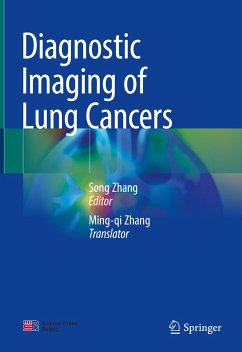 Diagnostic Imaging of Lung Cancers (eBook, PDF)