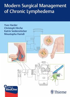 Cover Modern Surgical Management of Chronic Lymphedema (eBook, PDF)