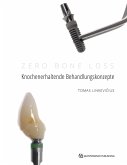 Zero Bone Loss: Knochenerhaltende Behandlungskonzepte (eBook, ePUB)