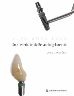 Cover Zero Bone Loss: Knochenerhaltende Behandlungskonzepte (eBook, ePUB)