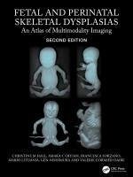 Cover Fetal and Perinatal Skeletal Dysplasias