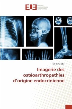 Imagerie des ostéoarthropathies d¿origine endocrinienne - Aoudia, Lynda