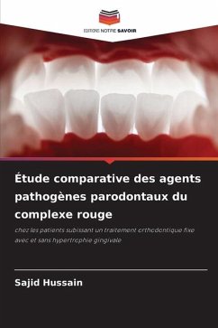 Étude comparative des agents pathogènes parodontaux du complexe rouge - Hussain, Sajid