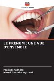 LE FRENUM : UNE VUE D'ENSEMBLE