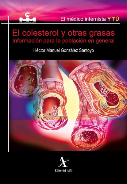 El colesterol y otras grasas. Información para la población en general (eBook, PDF) El colesterol y otras grasas. Información para la población en general (eBook, PDF)