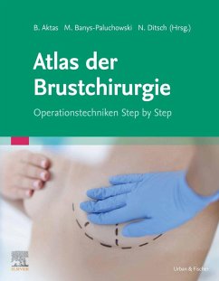 Atlas der Brustchirurgie (eBook, ePUB)