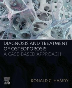 Diagnosis and Treatment of Osteoporosis (eBook, ePUB) - Hamdy, Ronald C.