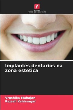 Implantes dentários na zona estética - Mahajan, Vrushika;Kshirsagar, Rajesh