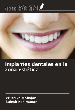 Cover Implantes dentales en la zona estética