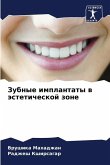 Zubnye implantaty w ästeticheskoj zone