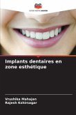 Implants dentaires en zone esthétique