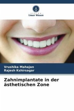 Zahnimplantate in der ästhetischen Zone - Mahajan, Vrushika;Kshirsagar, Rajesh