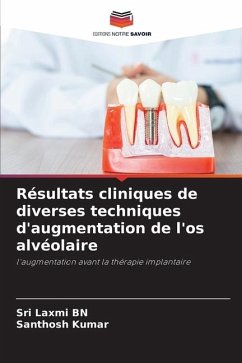 Résultats cliniques de diverses techniques d'augmentation de l'os alvéolaire - BN, Sri Laxmi;Kumar, Santhosh