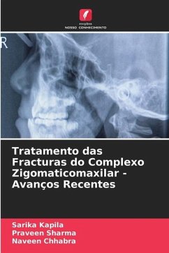 Tratamento das Fracturas do Complexo Zigomaticomaxilar - Avanços Recentes - Kapila, Sarika;Sharma, Praveen;Chhabra, Naveen