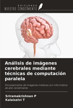 Cover Análisis de imágenes cerebrales mediante técnicas de computación paralela