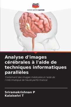 Analyse d'images cérébrales à l'aide de techniques informatiques parallèles - P, Sriramakrishnan;T, Kalaiselvi