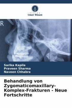 Behandlung von Zygomaticomaxillary-Komplex-Frakturen - Neue Fortschritte - Kapila, Sarika;Sharma, Praveen;Chhabra, Naveen