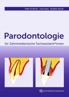 Parodontologie für Zahnmedizinische Fachassistent*innen (eBook, ePUB) - Eickholz, Peter; Elez, Ivana; Strauß, Brigitte