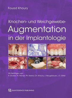 Knochen- und Weichgewebeaugmentation in der Implantologie (eBook, ePUB)