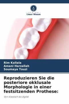 Reproduzieren Sie die posteriore okklusale Morphologie in einer festsitzenden Prothese: - Kallala, Rim;Harzallah, Amani;Touzi, Soumaya