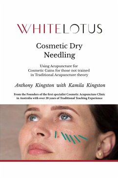 Cosmetic Dry Needling - Using Acupuncture for Cosmetic Gains for Those Not Trained in Traditional Acupuncture Theory (eBook, ePUB) - Kingston, Anthony