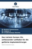 Das Lächeln formen: Ein umfassender Leitfaden für die geführte Implantatchirurgie