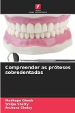 Compreender as próteses sobredentadas