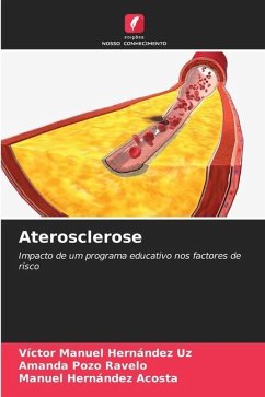 Aterosclerose - Hernández Uz, Víctor Manuel;Pozo Ravelo, Amanda;Hernández Acosta, Manuel