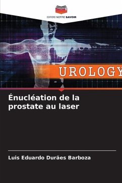 Énucléation de la prostate au laser - Barboza, Luis Eduardo Durães