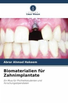 Biomaterialien für Zahnimplantate - HAKEEM, ABRAR AHMAD