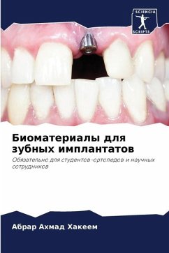 Biomaterialy dlq zubnyh implantatow - HAKEEM, ABRAR AHMAD
