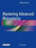 Mastering Advanced Rhinoplasty (eBook, ePUB)