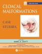 Cloacal Malformations: Case Studies... - Bild 1