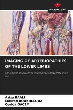 IMAGING OF ARTERIOPATHIES OF THE LOWER LIMBS - BAALI, Aziza;Boukheloua, Mourad;GACEM, OURIDA