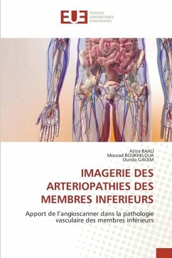 IMAGERIE DES ARTERIOPATHIES DES MEMBRES INFERIEURS - BAALI, Aziza;Boukheloua, Mourad;GACEM, OURIDA