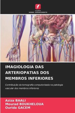 IMAGIOLOGIA DAS ARTERIOPATIAS DOS MEMBROS INFERIORES - BAALI, Aziza;Boukheloua, Mourad;GACEM, OURIDA